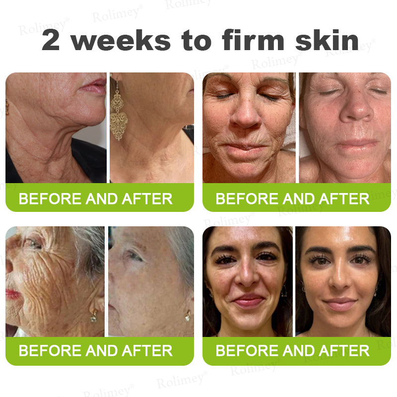Made and shipped from Australia🦘Rolimey® Botox & Vita-A Retinol Shot Wrinkle-Lift Tightening cream - Last Day Promotion 70% OFF