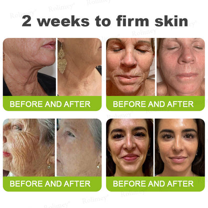 Made and shipped from Australia🦘Rolimey® Botox & Vita-A Retinol Shot Wrinkle-Lift Tightening cream - Last Day Promotion 70% OFF