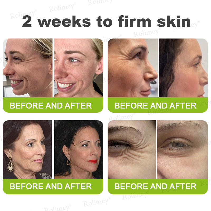 Made and shipped from Australia🦘Rolimey® Botox & Vita-A Retinol Shot Wrinkle-Lift Tightening cream - Last Day Promotion 70% OFF