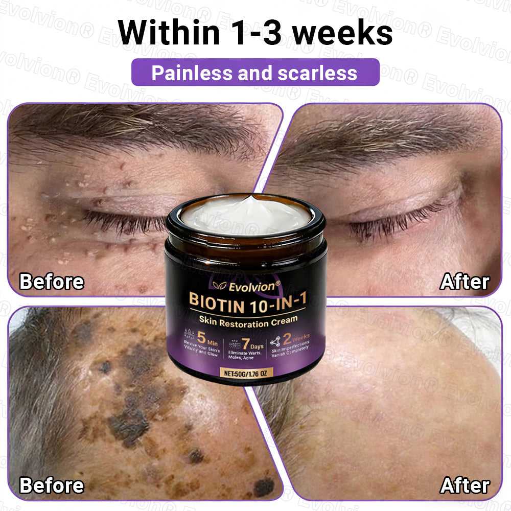 Made and Shipped from Australia🦘🔖Evolvion® Biotin 10-in-1 All-in-One Barrier Repair Cream - Last Day Promotion: 50% OFF