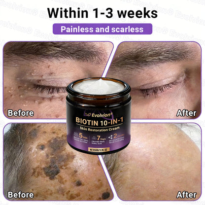 Made and Shipped from Australia🦘🔖Evolvion® Biotin 10-in-1 All-in-One Barrier Repair Cream - Last Day Promotion: 50% OFF