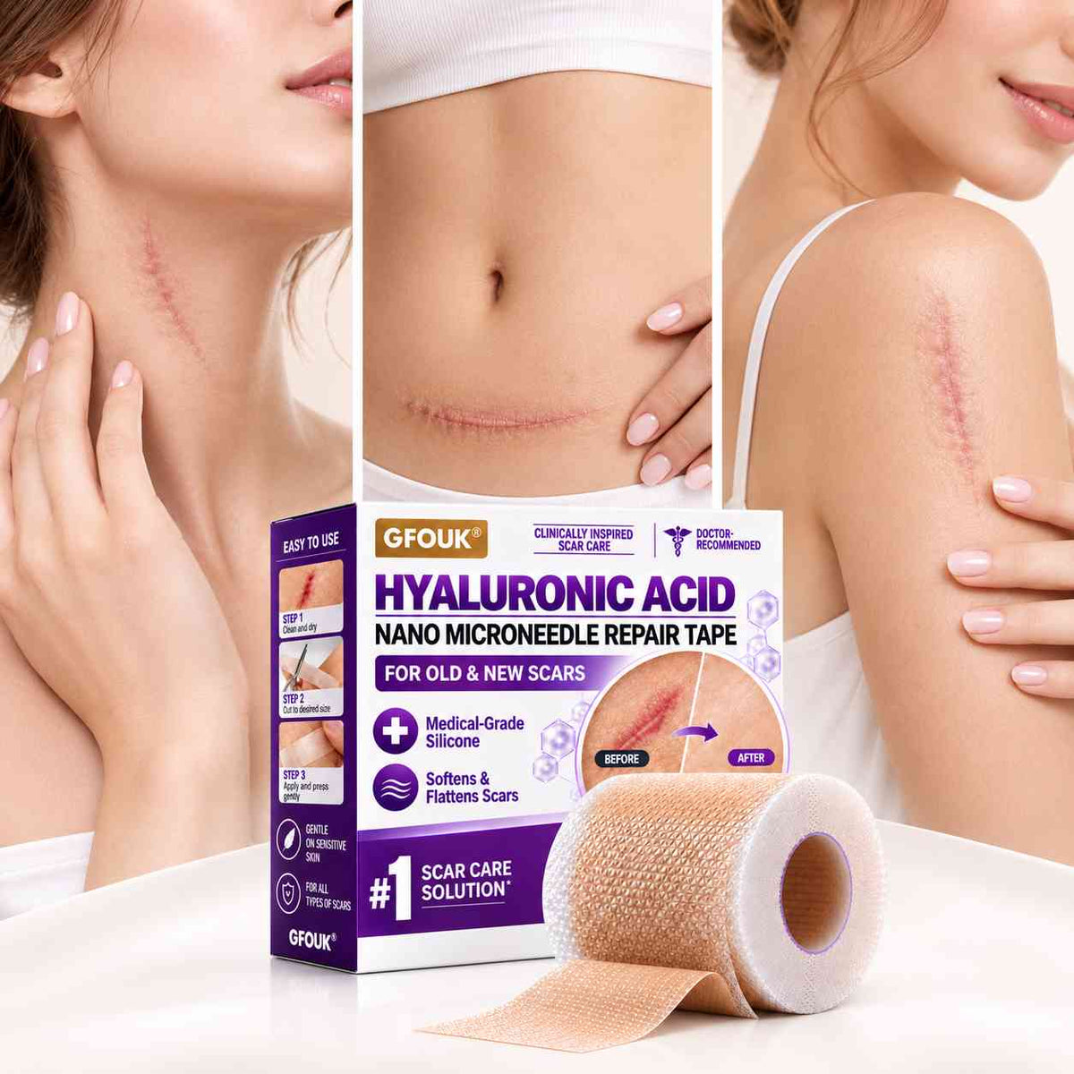 ✅GFOUK® Hyaluronic Acid Nano Microneedle Repair Tape🦘