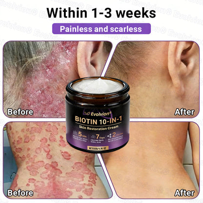 Made and Shipped from Australia🦘🔖Evolvion® Biotin 10-in-1 All-in-One Barrier Repair Cream - Last Day Promotion: 50% OFF
