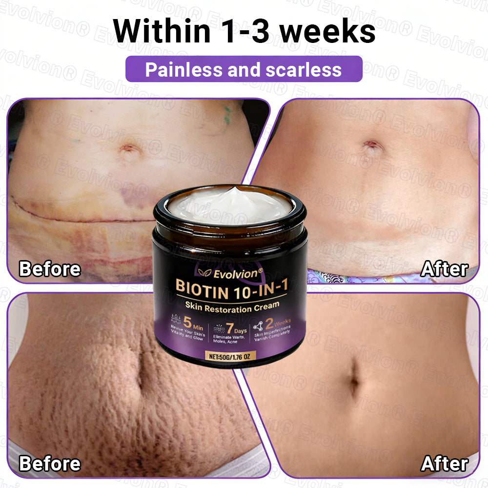 Made and Shipped from Australia🦘🔖Evolvion® Biotin 10-in-1 All-in-One Barrier Repair Cream - Last Day Promotion: 50% OFF