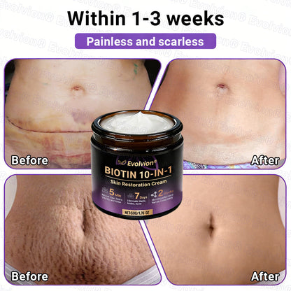 Made and Shipped from Australia🦘🔖Evolvion® Biotin 10-in-1 All-in-One Barrier Repair Cream - Last Day Promotion: 50% OFF