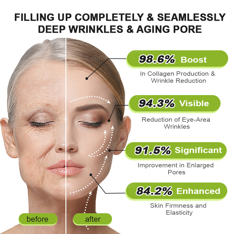 Made and shipped from Australia🦘Rolimey® Botox & Vita-A Retinol Shot Wrinkle-Lift Tightening cream - Last Day Promotion 70% OFF