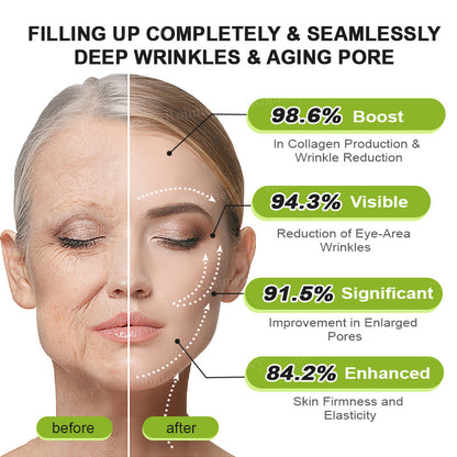 Made and shipped from Australia🦘Rolimey® Botox & Vita-A Retinol Shot Wrinkle-Lift Tightening cream - Last Day Promotion 70% OFF