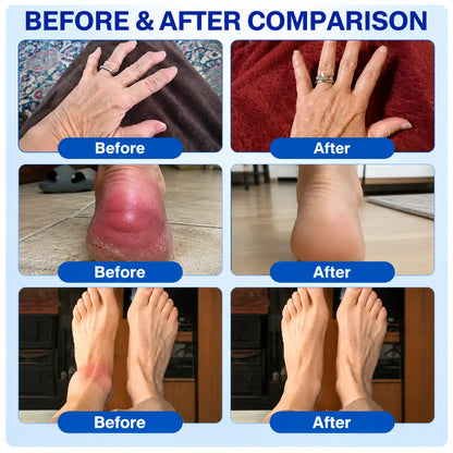 🦘🌟GFOUK® Advanced Joint Support Cream