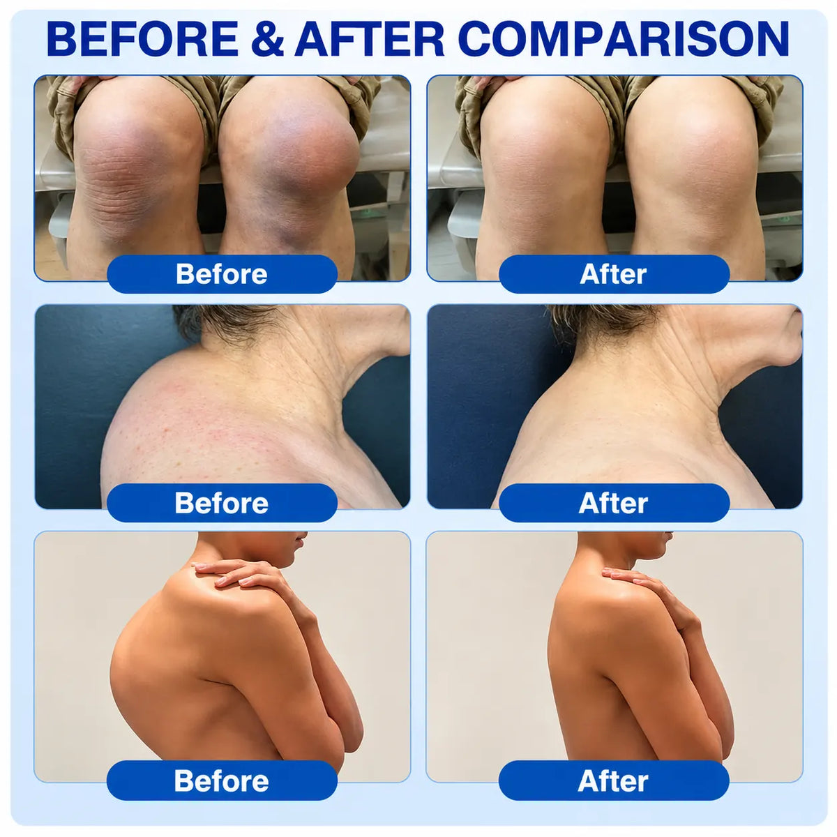 🦘🌟GFOUK® Advanced Joint Support Cream