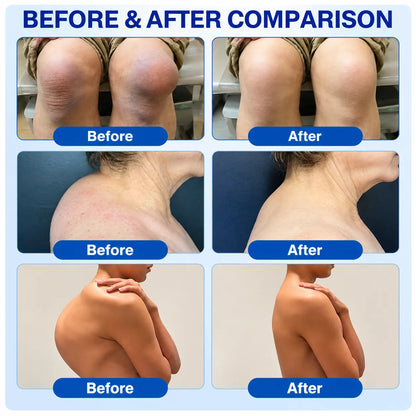 🦘🌟GFOUK® Advanced Joint Support Cream