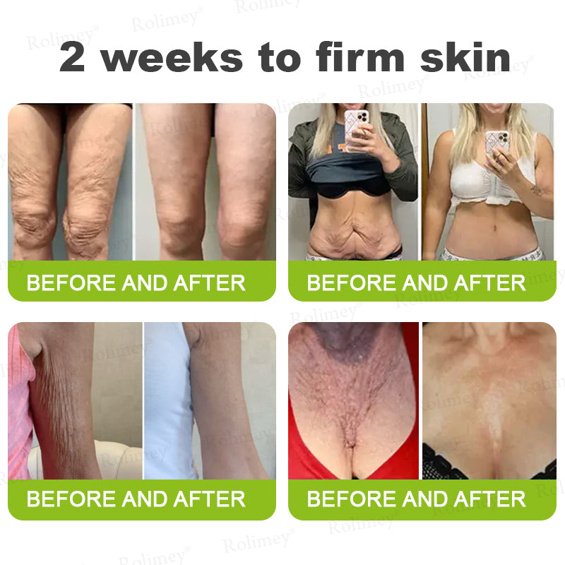 Made and shipped from Australia🦘Rolimey® Botox & Vita-A Retinol Shot Wrinkle-Lift Tightening cream - Last Day Promotion 70% OFF