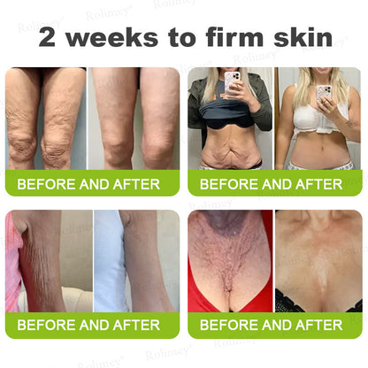 Made and shipped from Australia🦘Rolimey® Botox & Vita-A Retinol Shot Wrinkle-Lift Tightening cream - Last Day Promotion 70% OFF