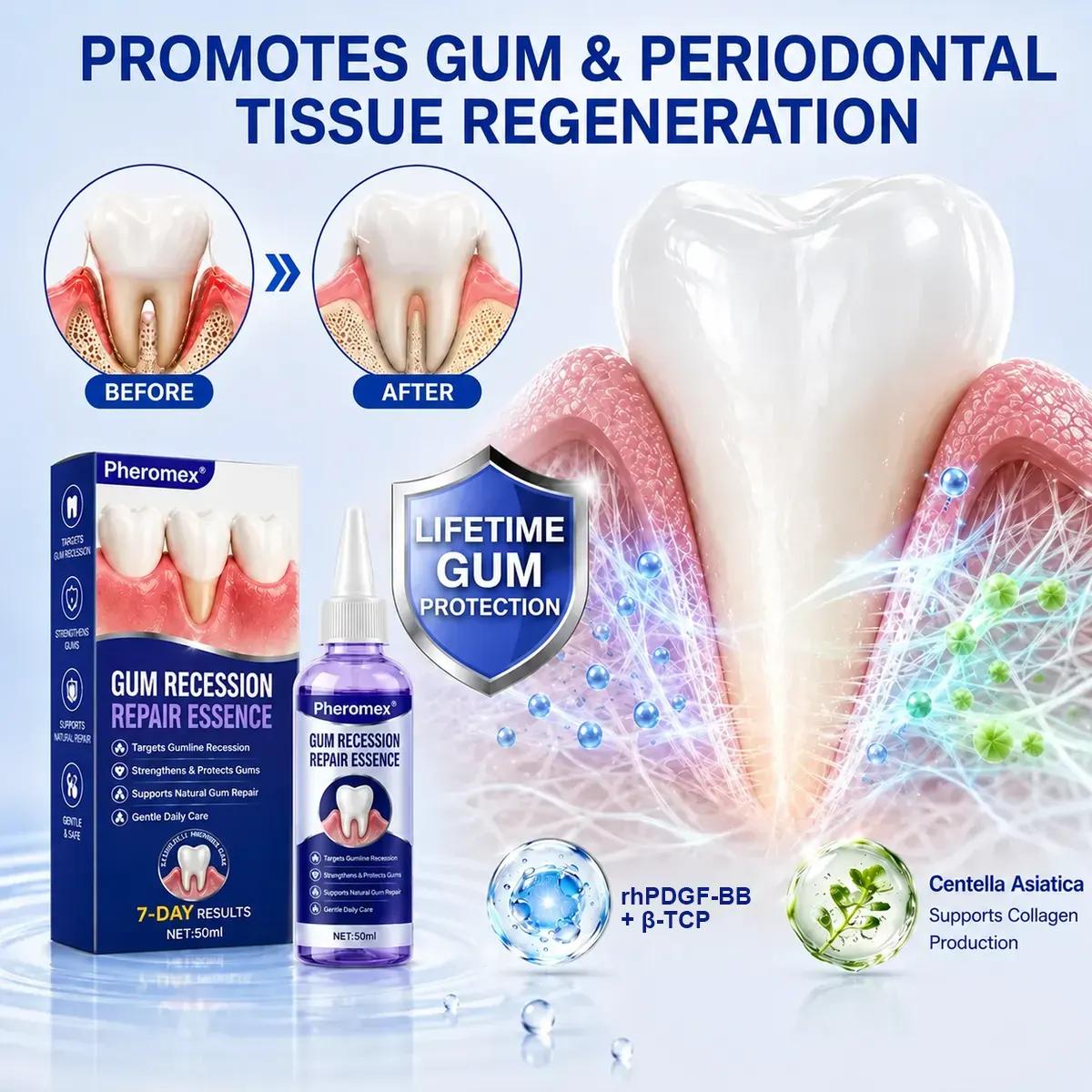 Pheromex®🦘GumRevive Periodontal Care Gel🦷