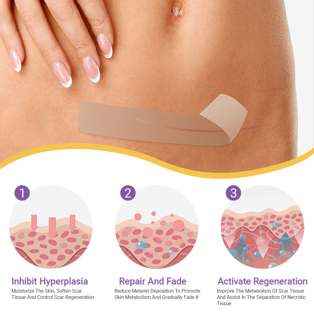 ✅GFOUK® Hyaluronic Acid Nano Microneedle Repair Tape🦘