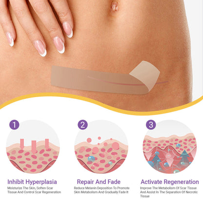 ✅GFOUK® Hyaluronic Acid Nano Microneedle Repair Tape🦘