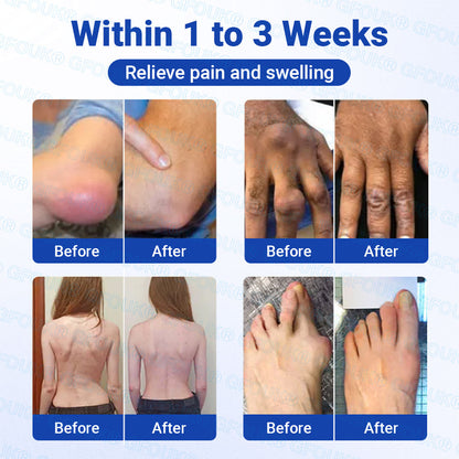 𝐎𝐟𝐟𝐢𝐜𝐢𝐚𝐥 𝐒𝐭𝐨𝐫𝐞 🇦🇺 |🦘GFOUK® BPC-157 × NSAID 10-in-1 Penetrating Greaseless Arthritis Gel
