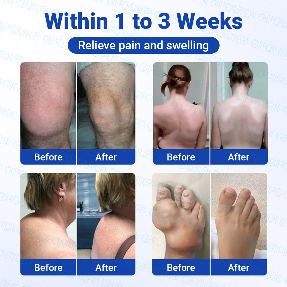 𝐎𝐟𝐟𝐢𝐜𝐢𝐚𝐥 𝐒𝐭𝐨𝐫𝐞 🇦🇺 |🦘GFOUK® BPC-157 × NSAID 10-in-1 Penetrating Greaseless Arthritis Gel