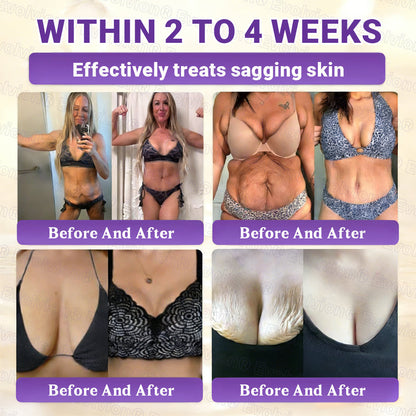 Made and Shipped from Australia🦘🔖Evolvion® Biotin 10-in-1 All-in-One Barrier Repair Cream - Last Day Promotion: 50% OFF