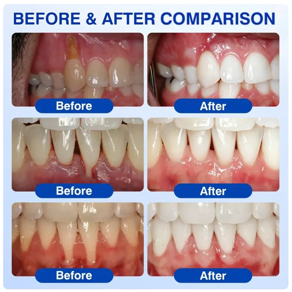 Pheromex®🦘GumRevive Periodontal Care Gel🦷
