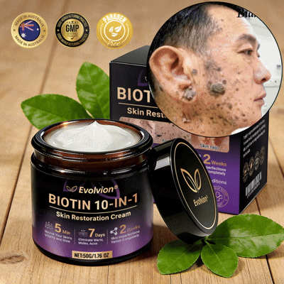 Made and Shipped from Australia🦘🔖Evolvion® Biotin 10-in-1 All-in-One Barrier Repair Cream - Last Day Promotion: 50% OFF