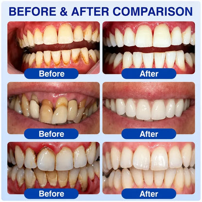 Pheromex®🦘GumRevive Periodontal Care Gel🦷