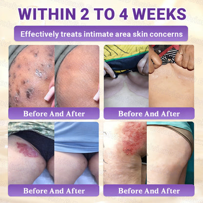 Made and Shipped from Australia🦘🔖Evolvion® Biotin 10-in-1 All-in-One Barrier Repair Cream - Last Day Promotion: 50% OFF