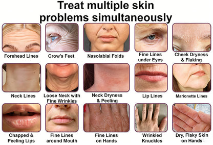 #1 Bestselling🏆--Rolimey® Calcium Multi Balm🦘👨‍⚕️Anti-Aging & Firming Skincare Stick🔥- Last Day Promotion 50% OFF