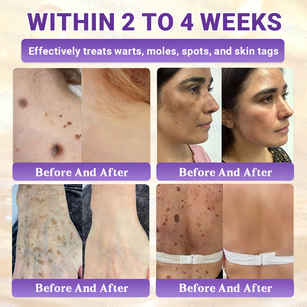 Made and Shipped from Australia🦘🔖Evolvion® Biotin 10-in-1 All-in-One Barrier Repair Cream - Last Day Promotion: 50% OFF