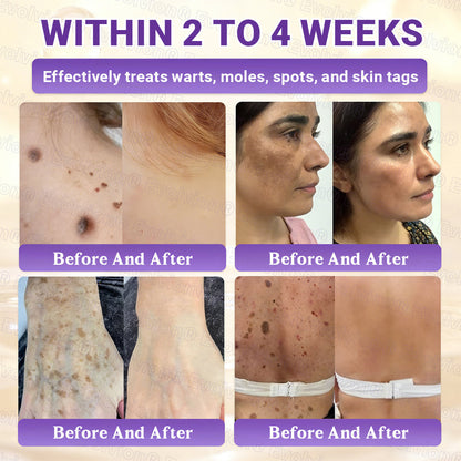 Made and Shipped from Australia🦘🔖Evolvion® Biotin 10-in-1 All-in-One Barrier Repair Cream - Last Day Promotion: 50% OFF