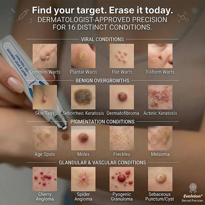 Made and Shipped from Australia🦘Evolvion® 𝟕-𝐃𝒂𝘆 𝐒𝗸𝐢𝐧 𝐓𝒂𝗴 & 𝐒𝐩𝙤𝐭 𝐄𝐫𝒂𝐬𝙚𝐫 Painless & Scar-Free Advanced Imperfection Remova𝗜 Ro𝗜𝗜erba𝗜𝗜 Pen