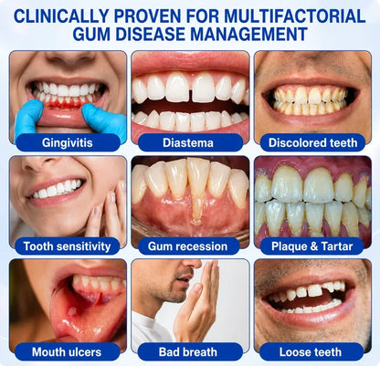 Pheromex®🦘GumRevive Periodontal Care Gel🦷
