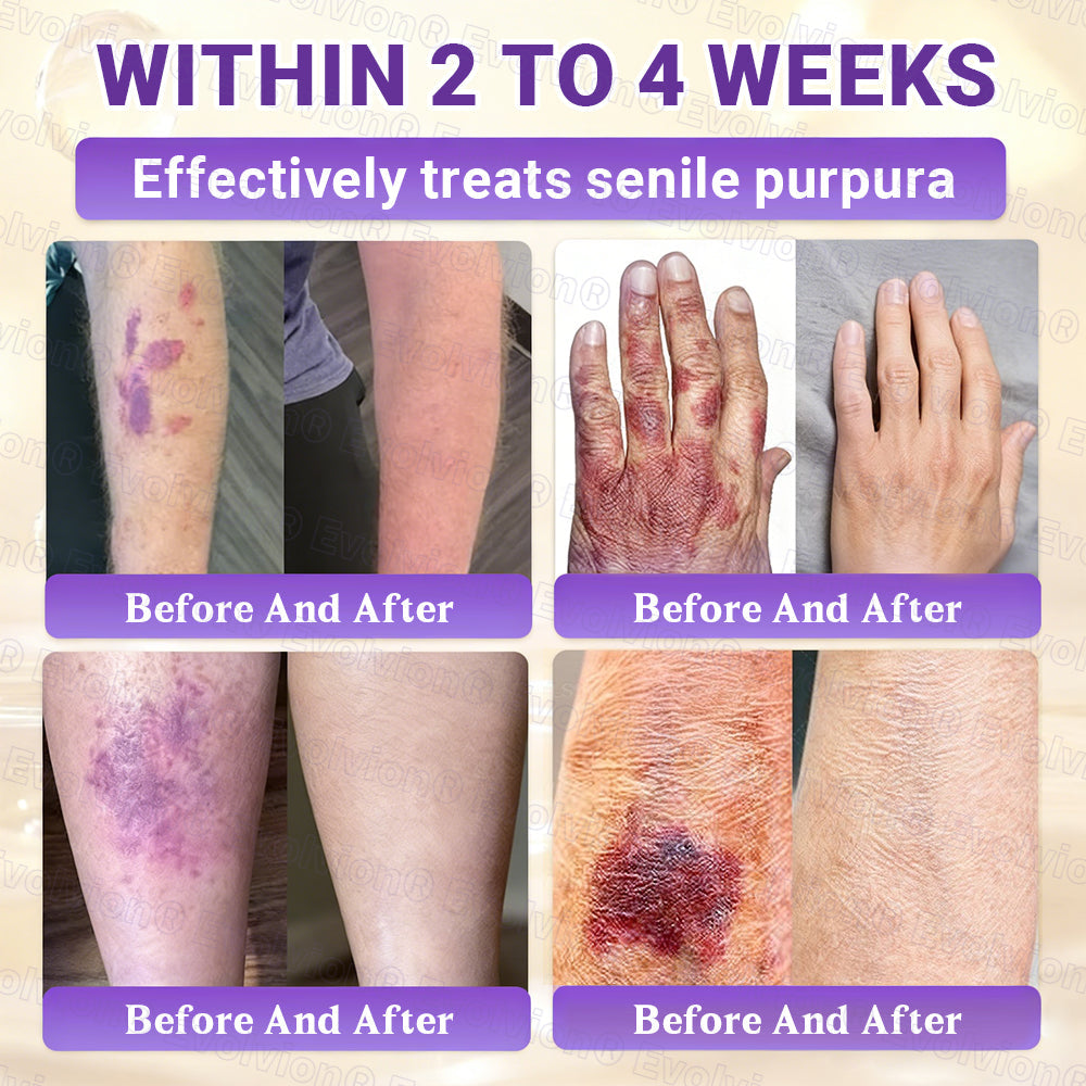 Made and Shipped from Australia🦘🔖Evolvion® Biotin 10-in-1 All-in-One Barrier Repair Cream - Last Day Promotion: 50% OFF