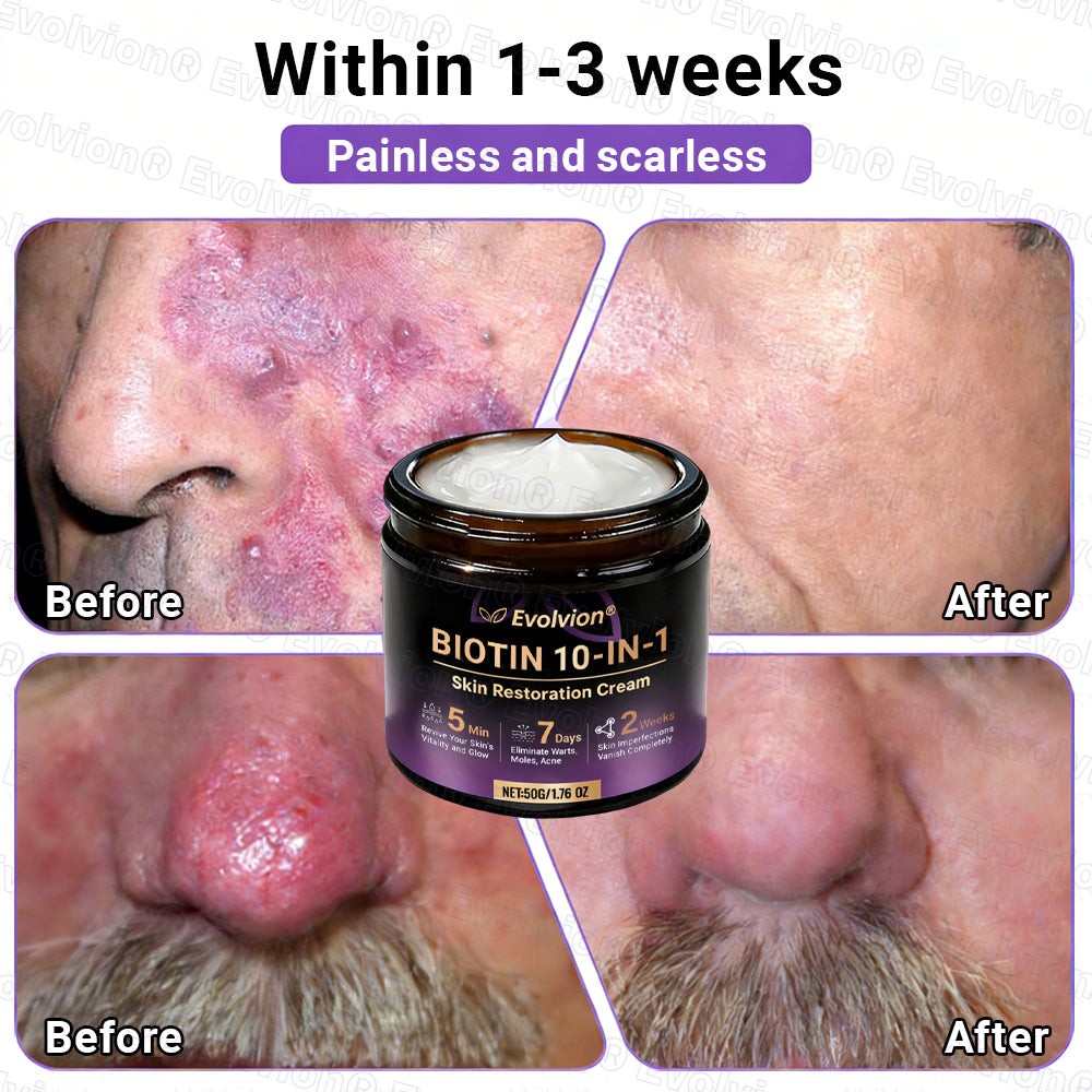 Made and Shipped from Australia🦘🔖Evolvion® Biotin 10-in-1 All-in-One Barrier Repair Cream - Last Day Promotion: 50% OFF