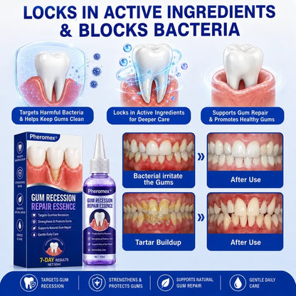 Pheromex®🦘GumRevive Periodontal Care Gel🦷
