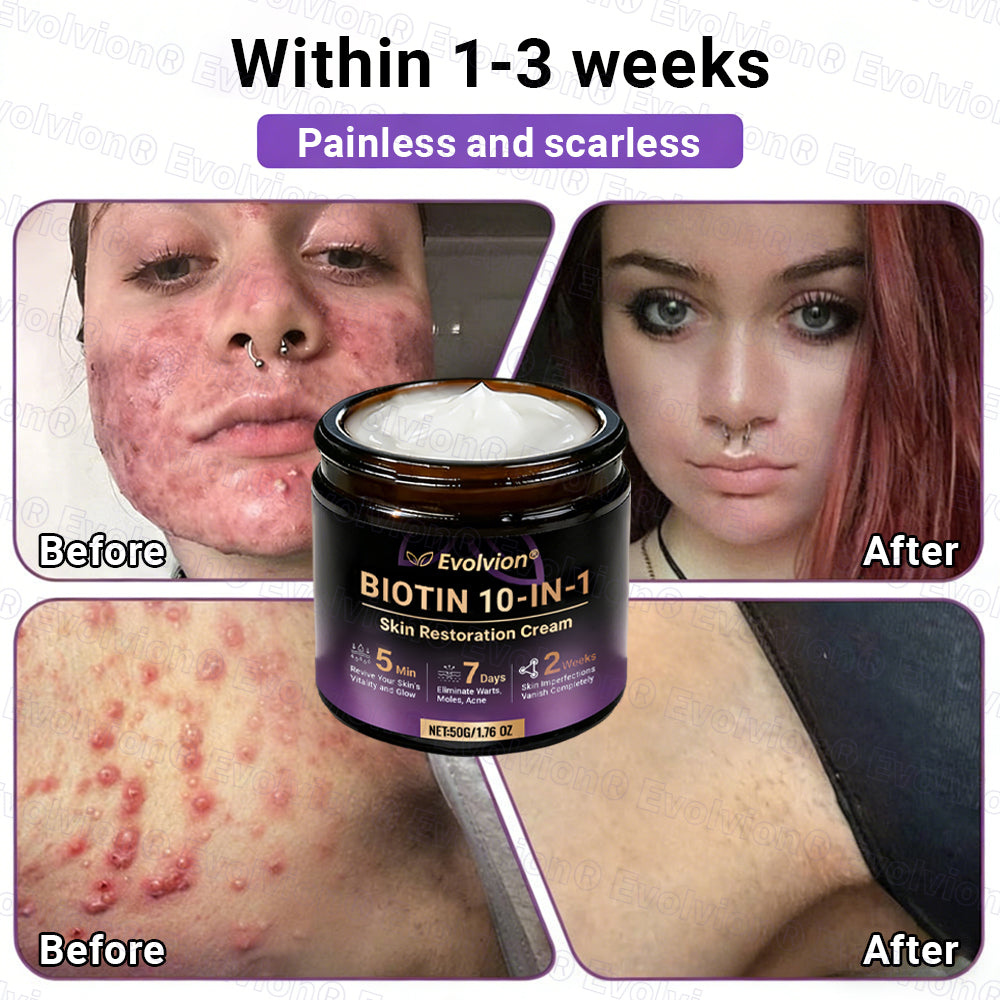 Made and Shipped from Australia🦘🔖Evolvion® Biotin 10-in-1 All-in-One Barrier Repair Cream - Last Day Promotion: 50% OFF