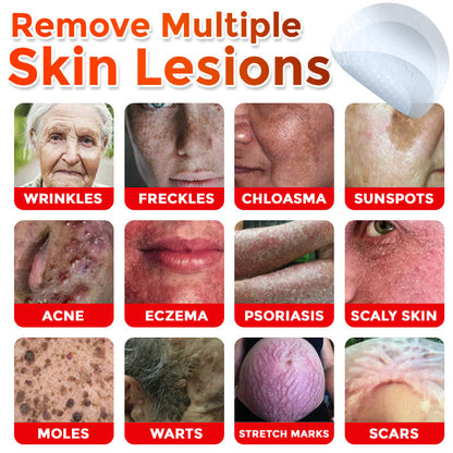 ❤️GFOUK® MicroNeedle Skin Tag Remover Patches - Botanic Formula | Fast Acting Australia