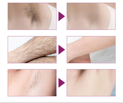 FAST HAIR REMOVAL SPRAY – SMOOTH, PAIN-FREE SKIN